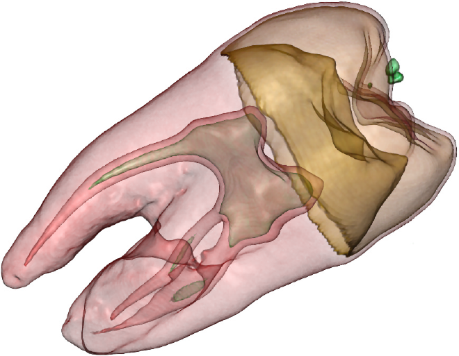 Fuente: Kniss, Interactive Volume Rendering Techniques.